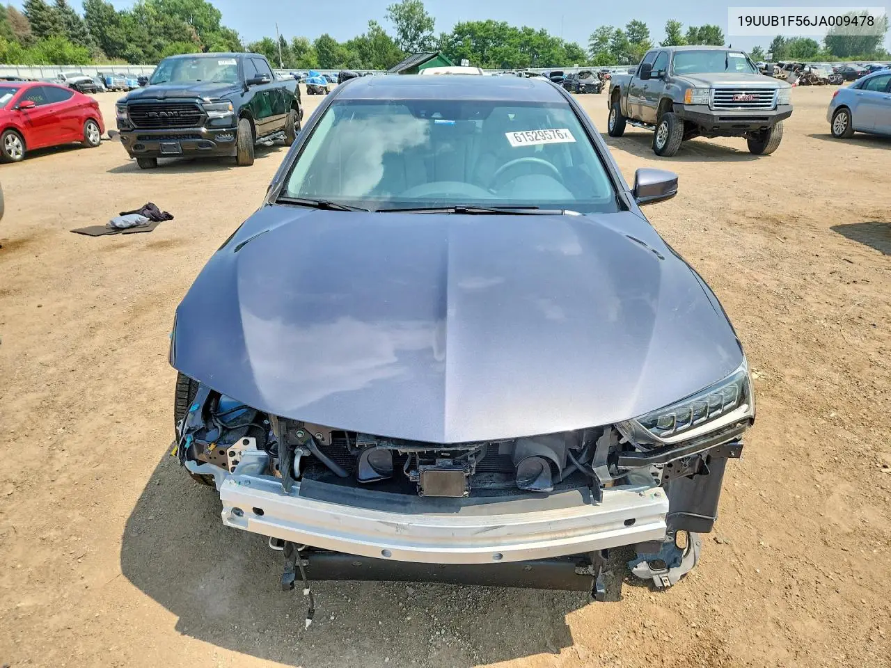 2018 Acura Tlx Tech VIN: 19UUB1F56JA009478 Lot: 61529576