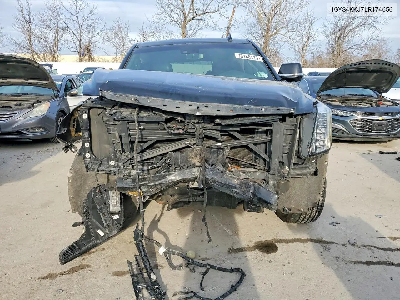 2020 Cadillac Escalade Esv Platinum VIN: 1GYS4KKJ7LR174656 Lot: 78188125