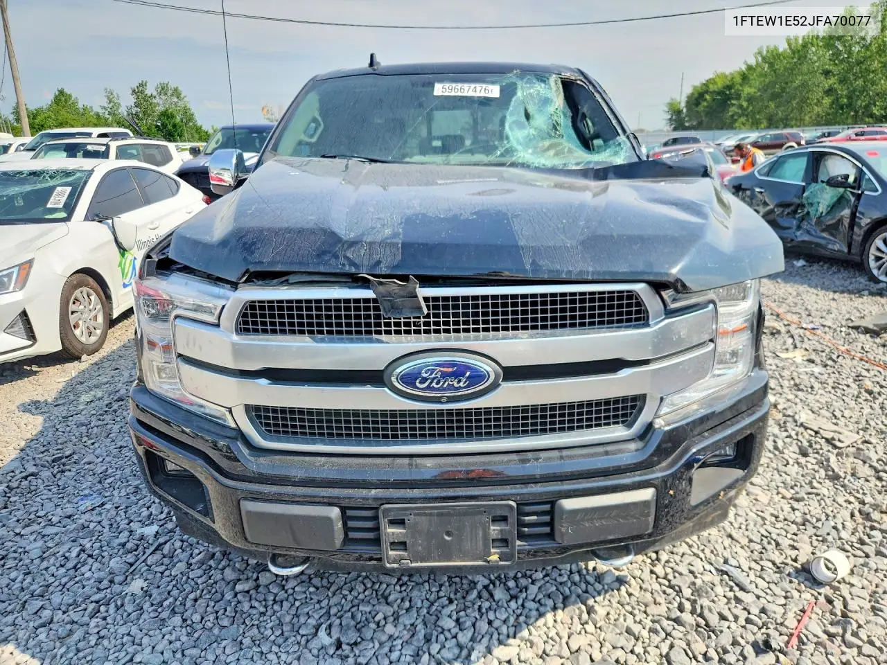 2018 Ford F150 Supercrew VIN: 1FTEW1E52JFA70077 Lot: 59667476