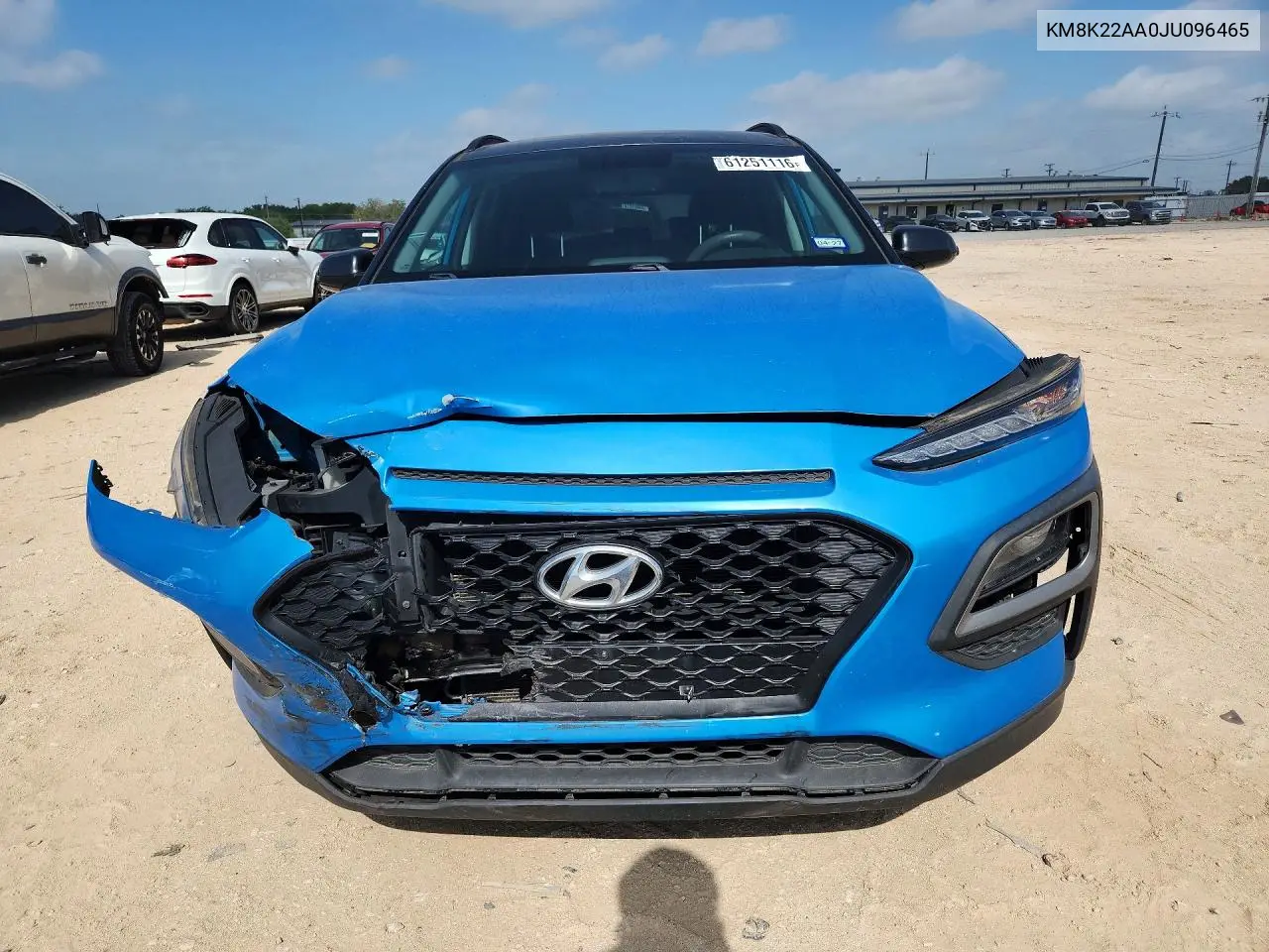 2018 Hyundai Kona Sel VIN: KM8K22AA0JU096465 Lot: 61251116